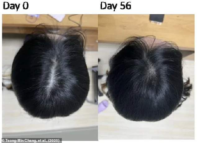 Potential Plant-Based Hair Loss Treatment Shows Promise in Two Months, Developed by Taiwanese Researchers