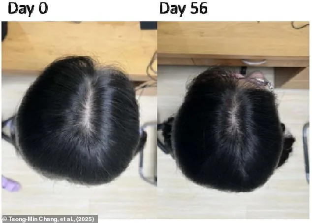 Potential Plant-Based Hair Loss Treatment Shows Promise in Two Months, Developed by Taiwanese Researchers