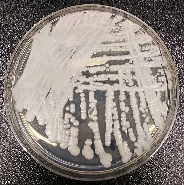 Deadly, Treatment-Resistant Fungus Candida Auris Spreading Rapidly in Hospitals, Fueling Public Health Crisis