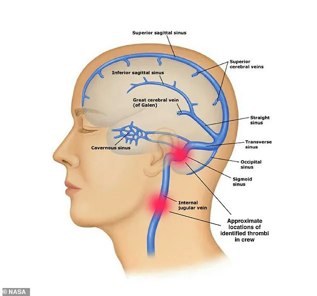 First ISS Medical Evacuation Underway as Astronaut Faces Serious Health Crisis in Orbit