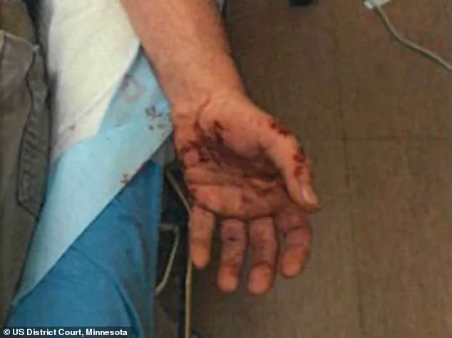 Late-Breaking: ICE Agent Reveals Past Scars in Court During Fatal Shooting Trial