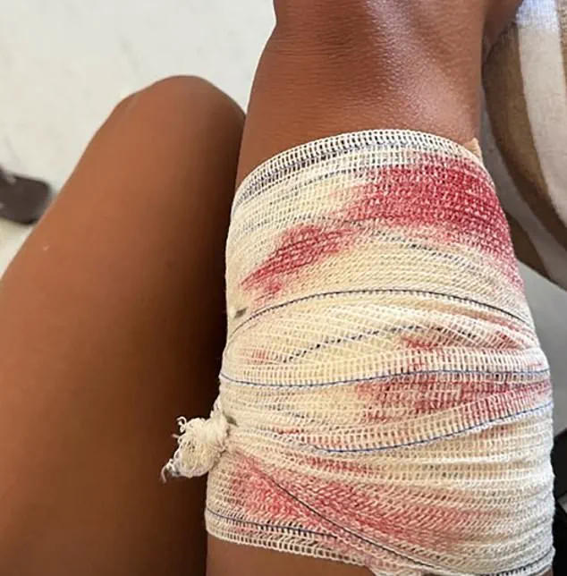 Nurse Shark Encounter at Brazil's UNESCO Site Raises Safety and Conservation Questions