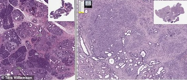 Global Outrage as Declassified CIA Documents Reveal Six-Decade Cover-Up Behind Potential Cancer Treatment Patent